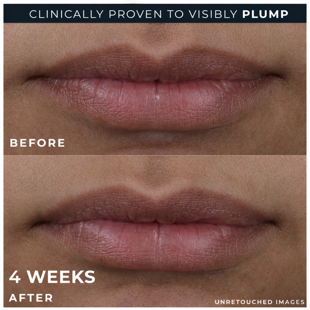 BEAULABS Lip Volumiser