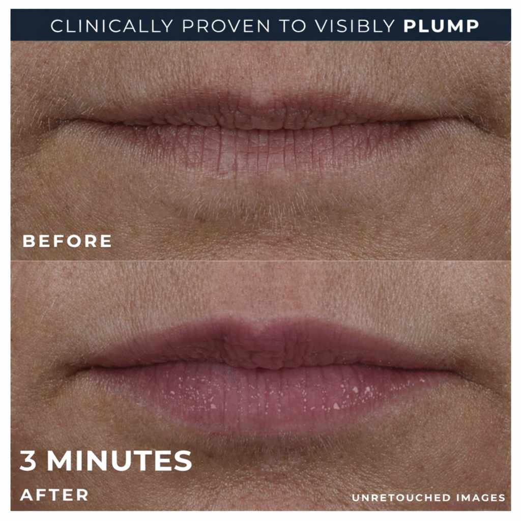 BEAULABS Lip Volumiser