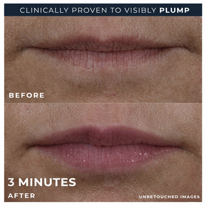 BEAULABS Lip Volumiser